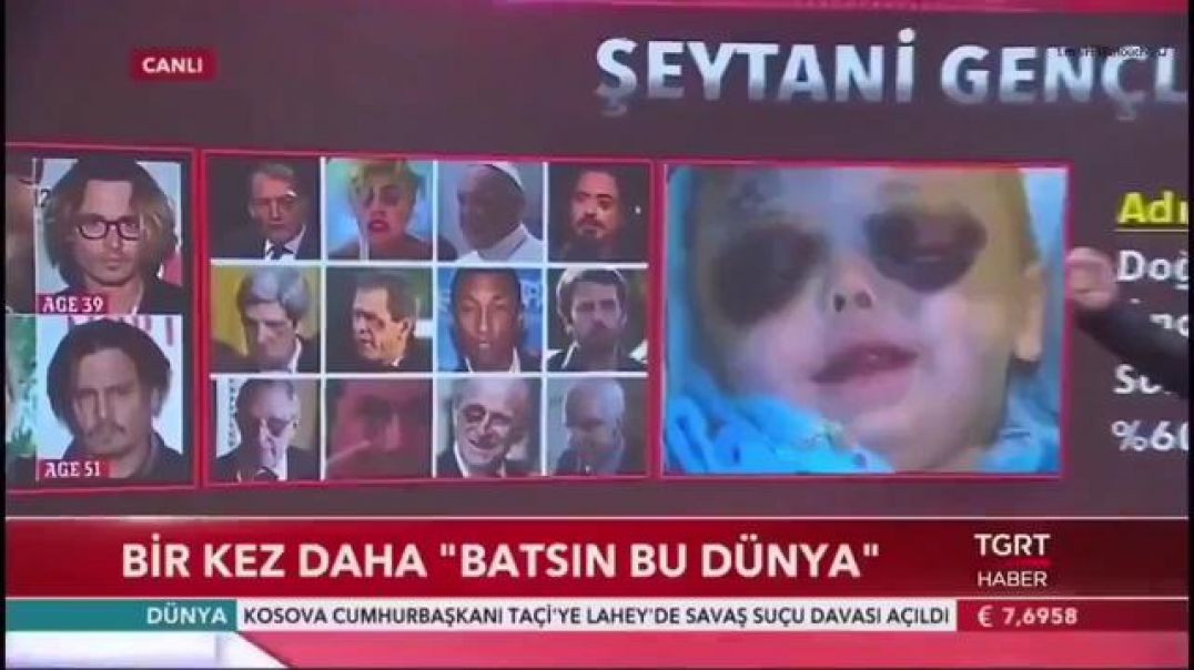 ⁣ADRENOCHROME HARVESTING BY THE WEST ⚽ MADE THE NEWS IN TURKEY & A NUMBER OF EAST EUROPEAN COUNTR