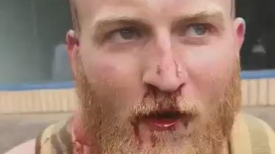 ⁣Red Bearded White Man Survives Muslim Defence League Child Rapist Stabbing With Beating!