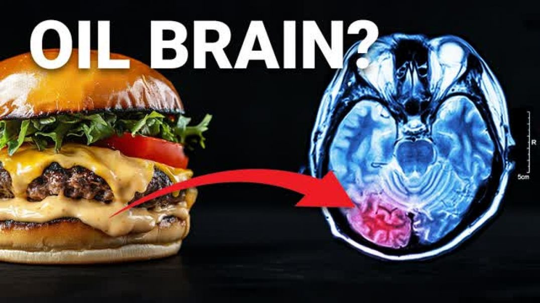 ⁣THE 💲212 BILLION DOLLAR FOOD INGREDIENT ☠ POISONING YOUR BRAIN