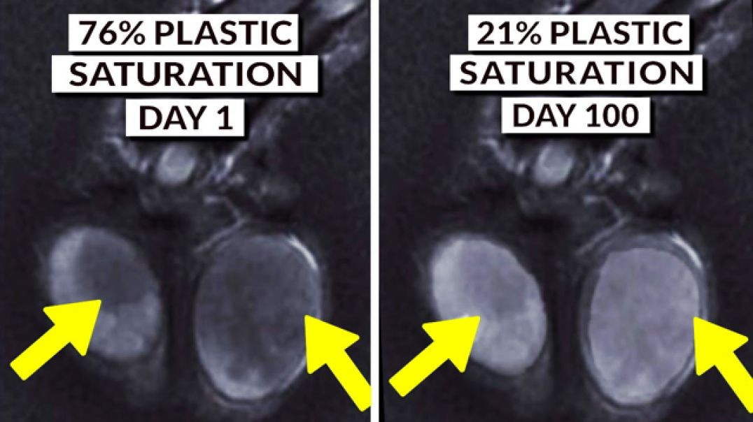 ⁣WE FINALLY KNOW HOW TO DETOX MICROPLASTICS FROM THE BODY❗