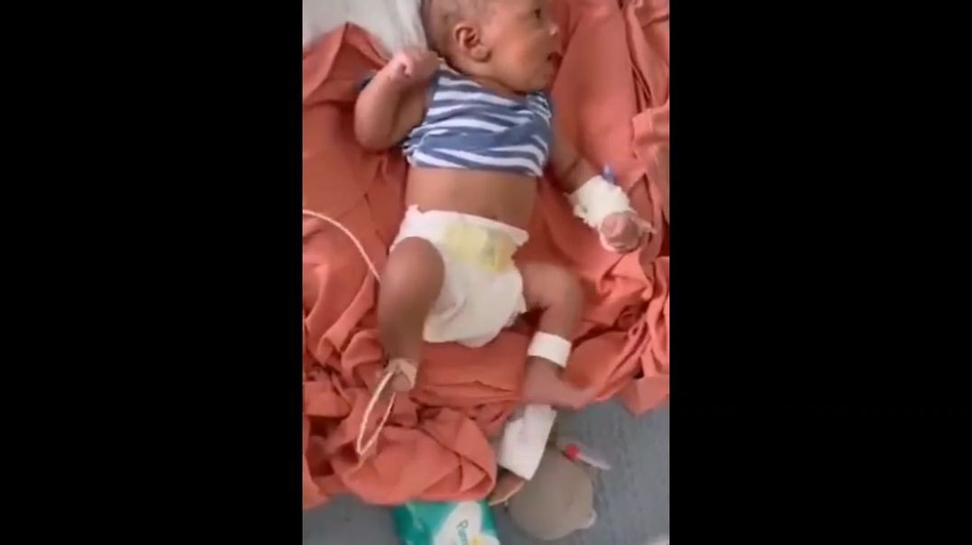 ⁣INFANT HAS COVID-19 VACCINE SIDE EFFECTS BECAUSE MOTHER WAS FORCED TO TAKE SHOT BEFORE DELIVERY❗