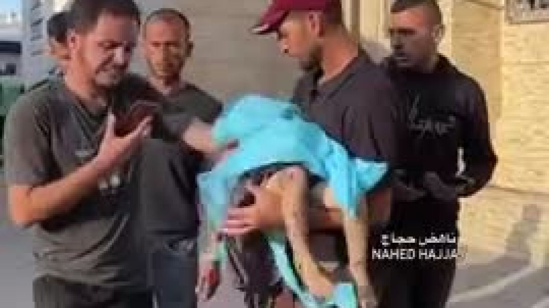 The US taxpayer funded jewish war hoax plastic girl!