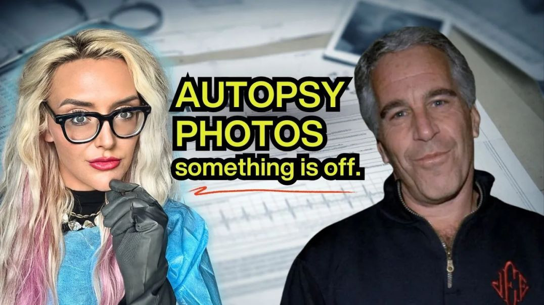 ⁣JEFFREY EPSTEINː THE AUTOPSY DETAILS NO ONE IS TALKING ABOUT