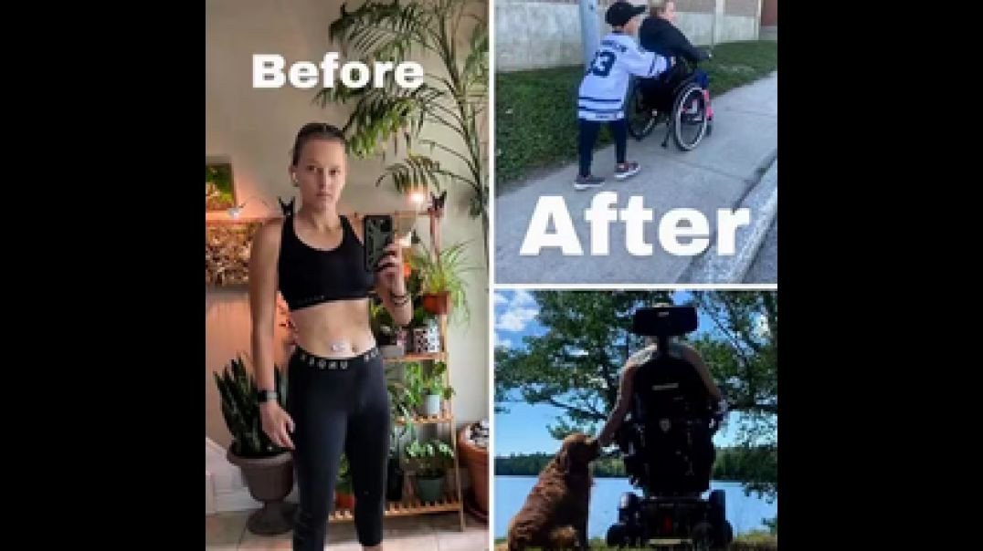 KAYLA POLLOCK HAS CONFIRMATION THAT HER PERMANENT PARALYSIS ⚕ WAS CAUSED BY THE COVID VACCINE❗