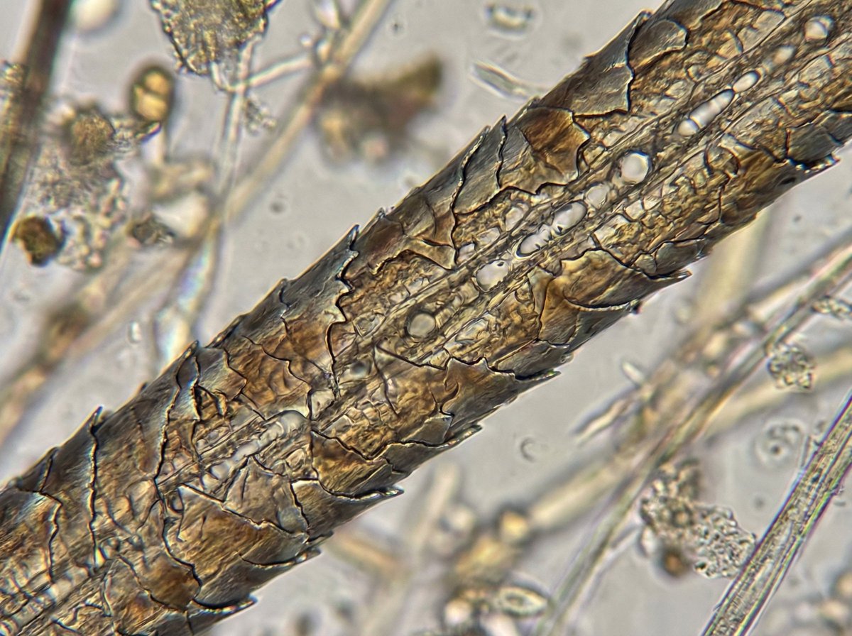 AI Prompt for Ultra-Realistic Microscopic Images