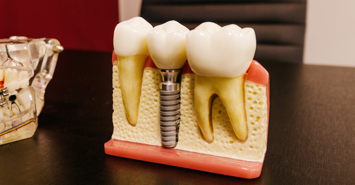 Dental Implants Johnstown OH