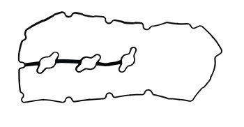 Engine Valve Cover Gasket