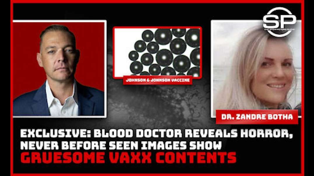 Stew Peters Never Before Seen Images From Blood Of The Vaccinated Exposure