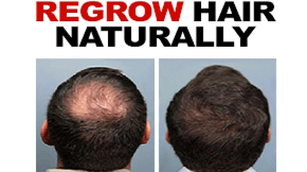 Hair loss stopped with 1 nutrient (new study) and regrow hair naturally