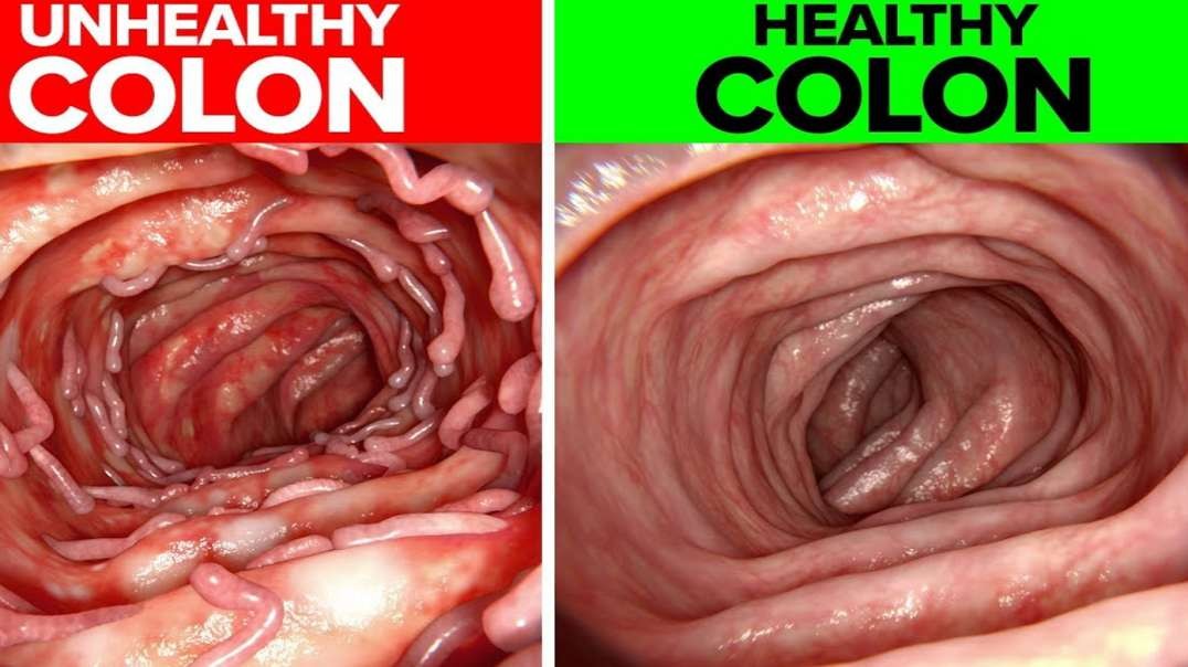 Effective Ways You Can Maintain A Healthy Colon