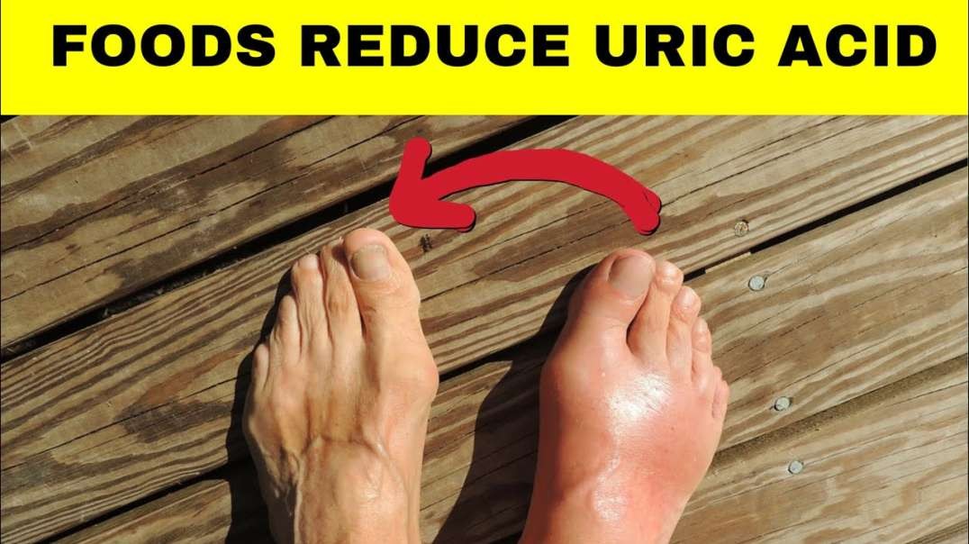 Foods to Reduce Uric Acid (Gout)