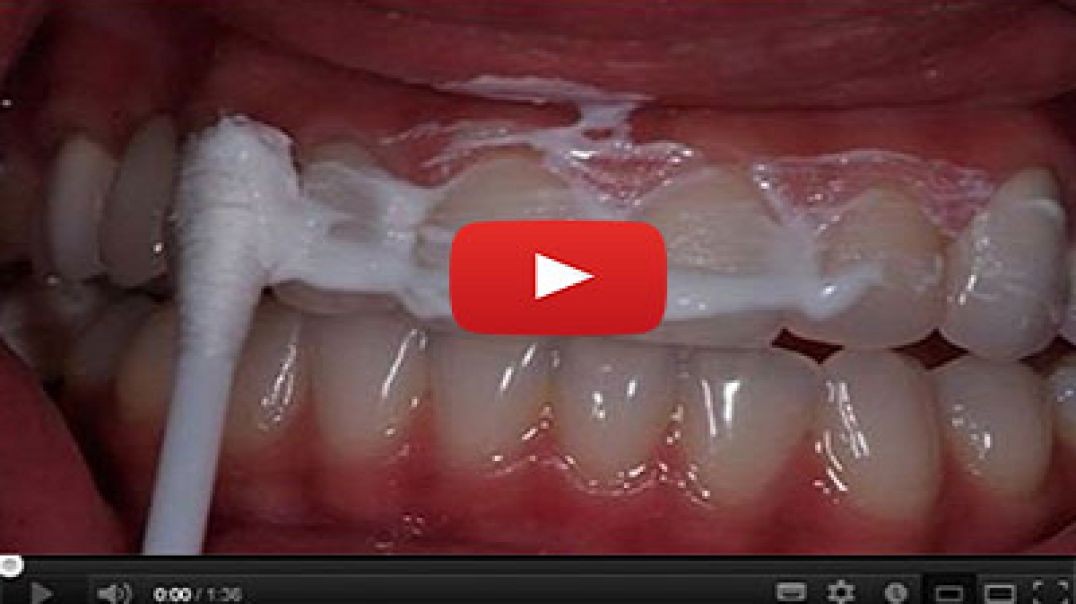 Do This 60 Seconds Dental Trick Before go to Bed Tonight To Rebuild Your Teeth and Gums
