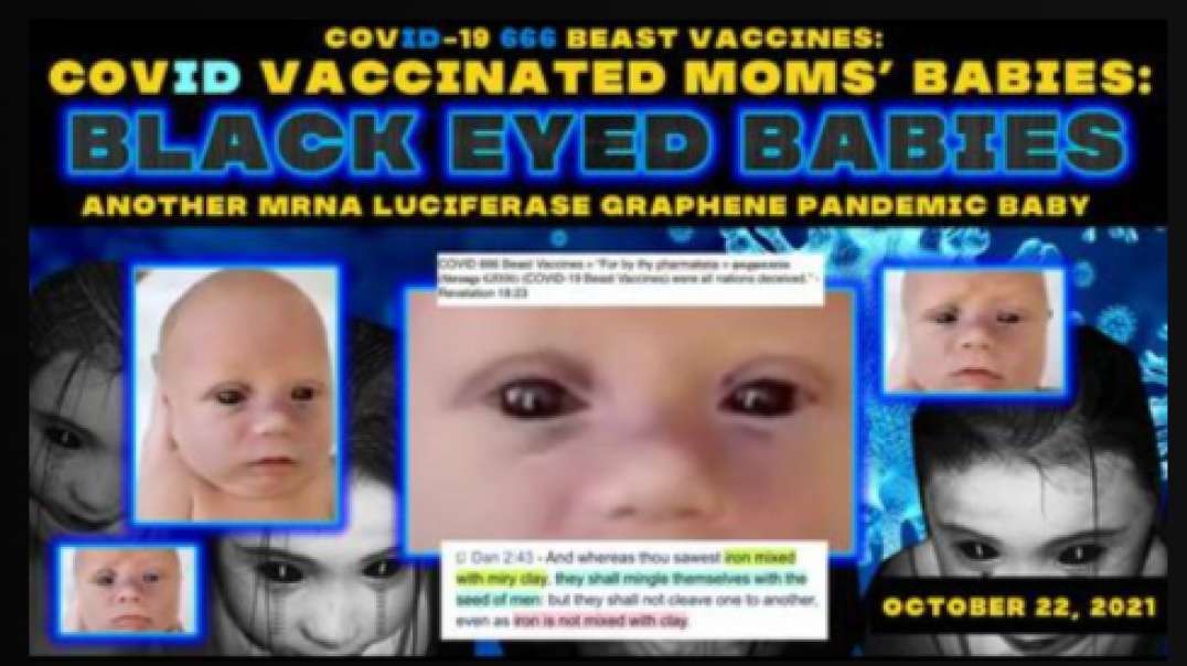 COVID 666 Vaccines! Black Eyed Babies! Another MRNA Luciferase Graphene Pandemic Baby!!