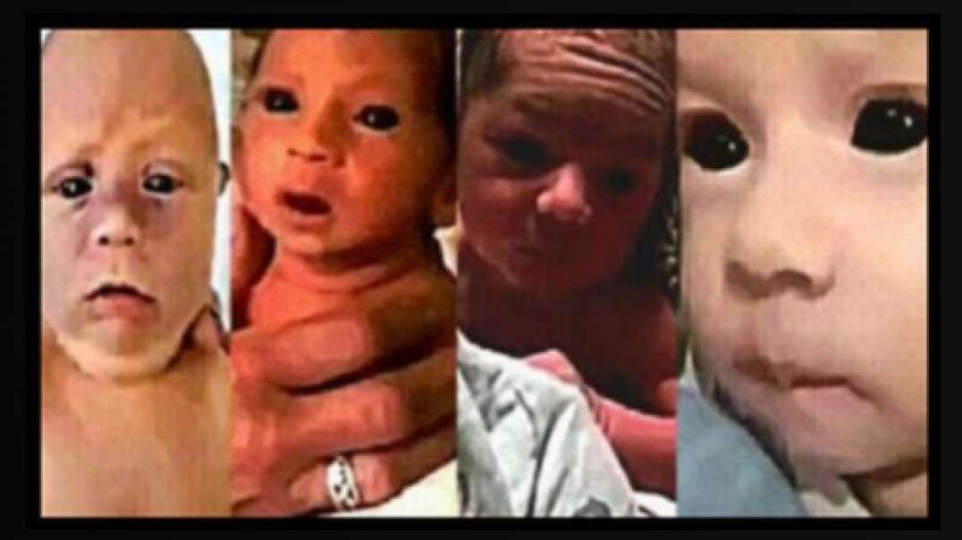 ~BLACK EYED BABY COMPILATION AND ANALYSIS. WHAT ARE THEY? HOW DID THIS HAPPEN?