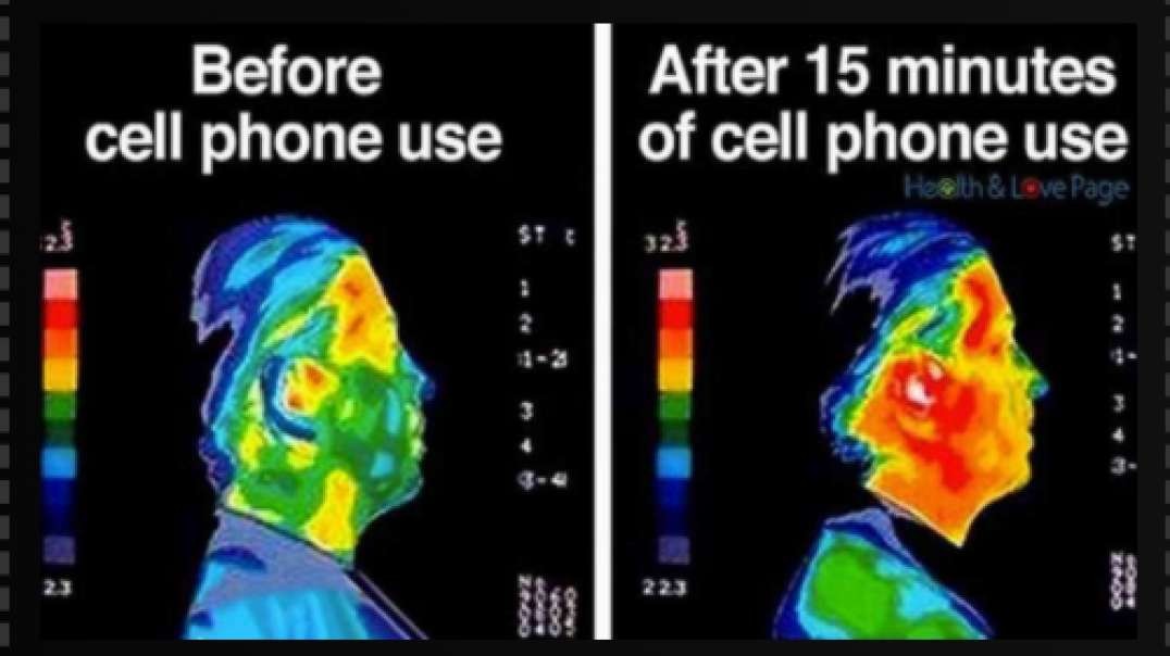 FDA Ignored Evidence Of Cell Phone Radiation!