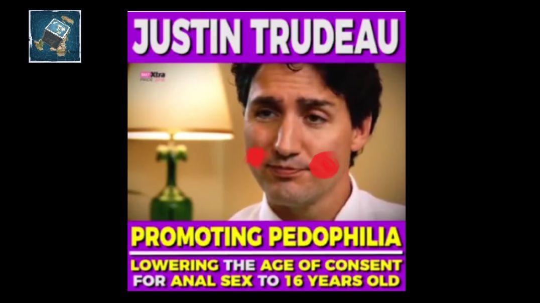 Why the Wobbly Head Trudeau?