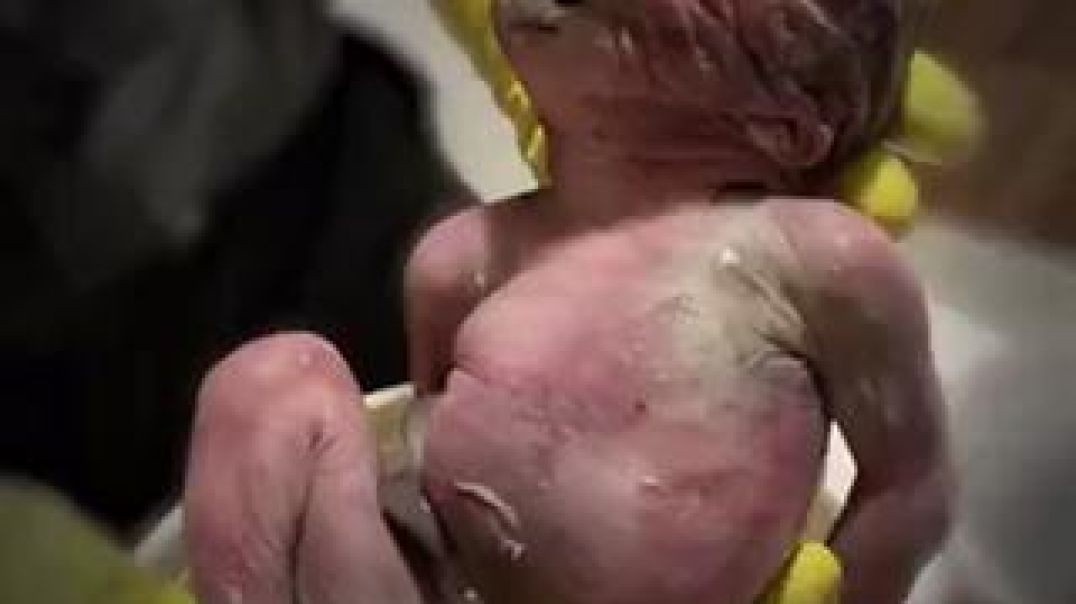 Discovered infant bodies may indicate infanticide after attempted abortions 👶☠️[GRAPHIC CONTENT]