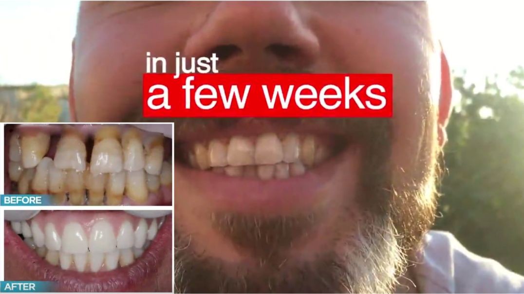 Rebuild Your Gums and Teeth and Get Rid of Tooth Decay in Just a Few Weeks!
