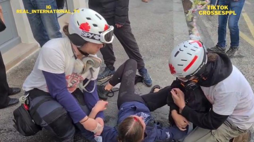 PARIS, Protester seriously injured with a cracked skull