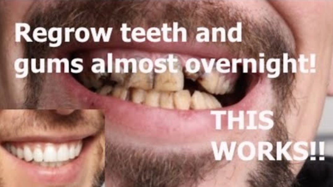 Swish This Sour Liquid In Your Mouth To Regrow Teeth And Gums Overnight