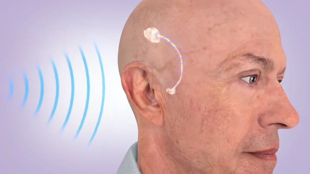 Top MIT Researchers Discovered the Incredible Hidden Cause of Ear Ringing!