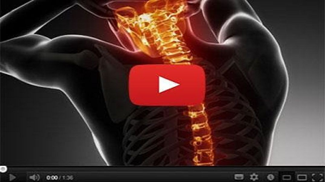 Doctors In Awe After Seeing How The Spine Looks After 1 Year Of Back Pain