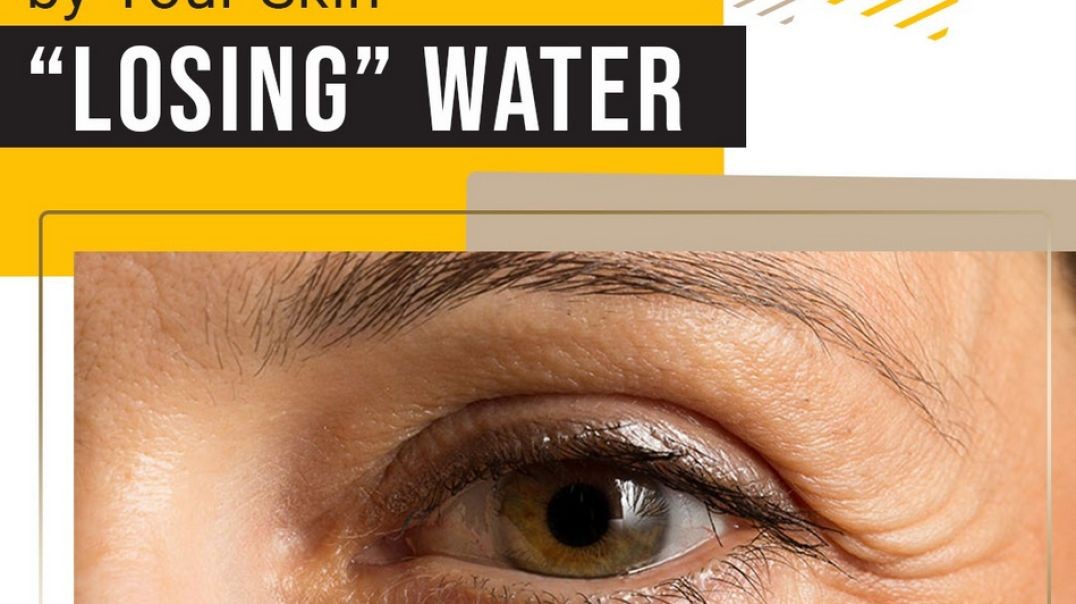 Wrinkles Caused By Your Skin “Losing” Water