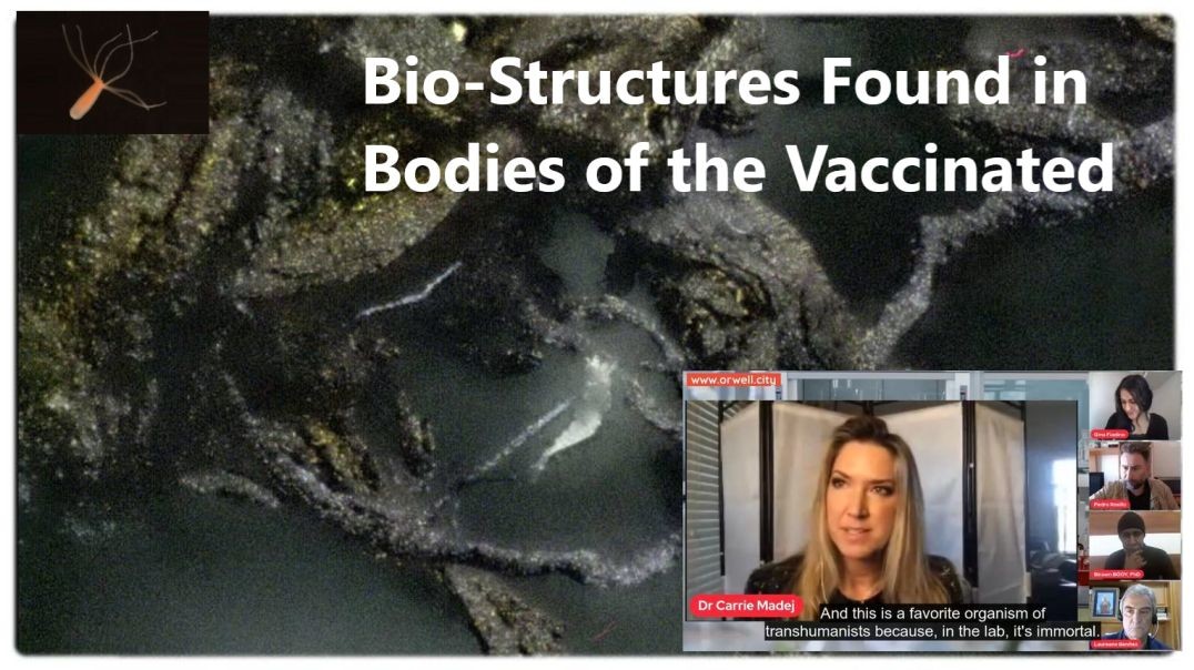 Massive Bio-Structures Found in Bodies of the Vaccinated [+NanoTech, Graphene Oxide]]