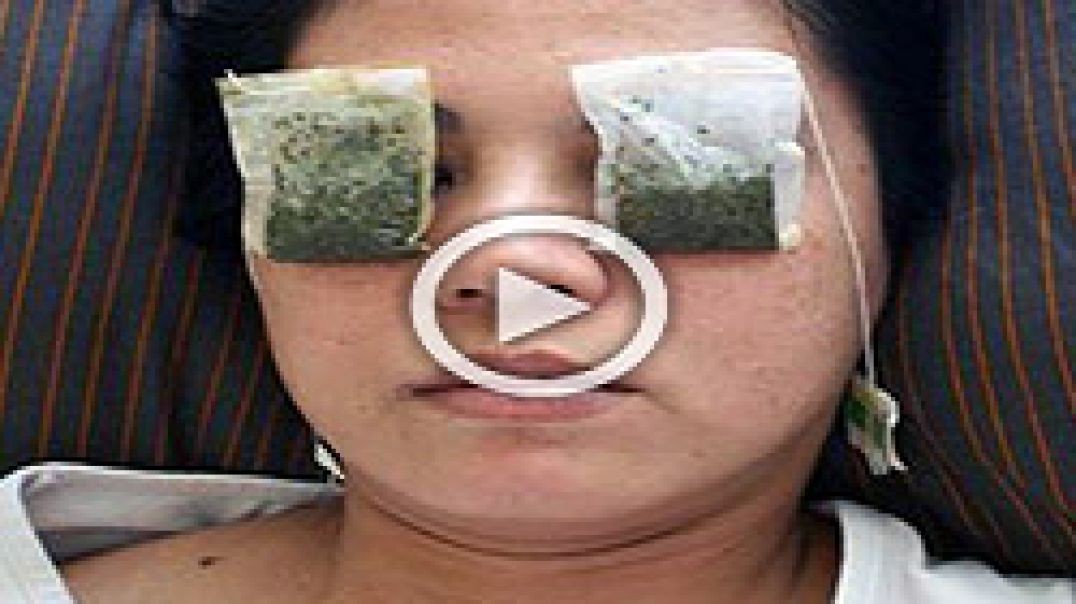 Do This Simple at Home Remedy to FIX Blurry Vision Naturally (Try it tonight)