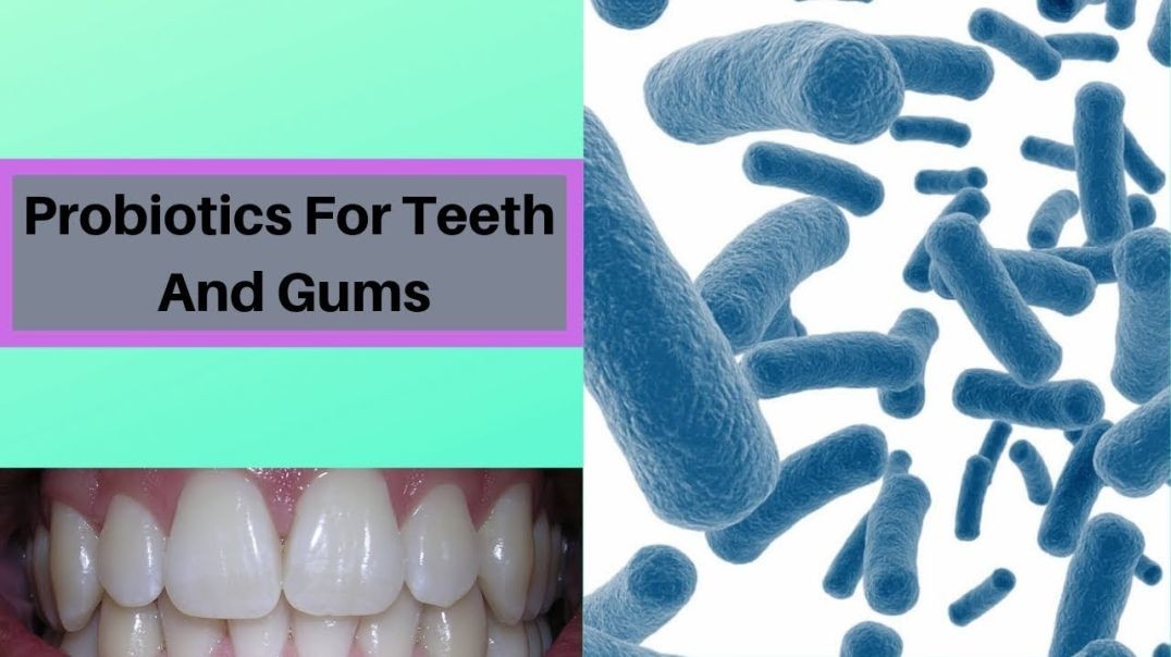 The Reason You Need To Take Probiotics For Teeth And Gums