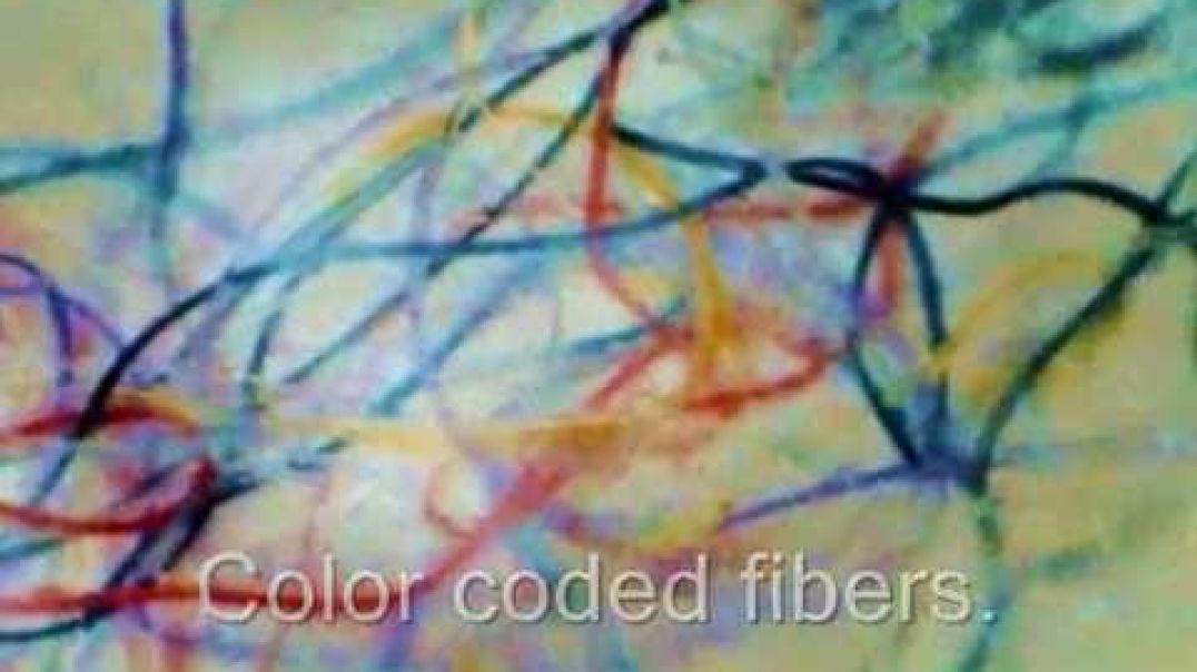 MHS 6 -  Morgellons : Synthetic Biology Fibers