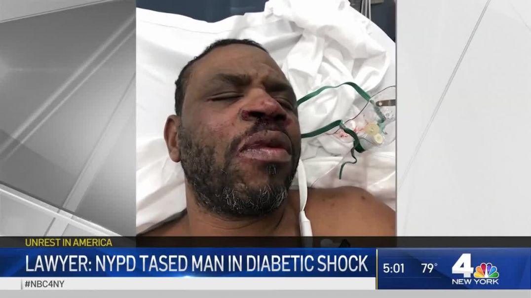⁣NYPD Tases Man in Diabetic Shock, Another Man Loses Sight After Being Tased