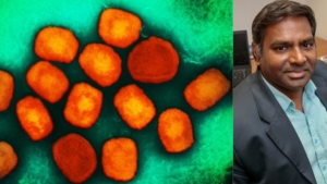 UCLA, NIH grant boosts Dr. Arumugaswami’s mpox research