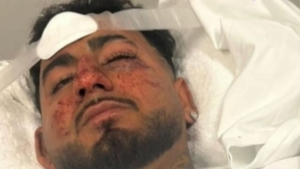 Indian student attacked in Australian hate crime