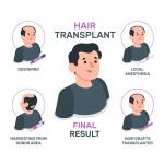 Hair Transplant Cost In India Profile Picture
